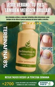 TERBINAFINA GOTAS ANTIFÚNGICAS